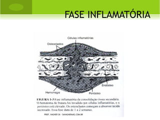 C LASSIFICAÇÃO DE RISSER




PROF. VAGNER SÁ - SAVAGNER@IG.COM.BR
 