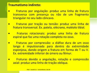 D ORSO C URVO J UVENIL E
                         S CHEUERMANN




PROF. VAGNER SÁ - SAVAGNER@IG.COM.BR
 