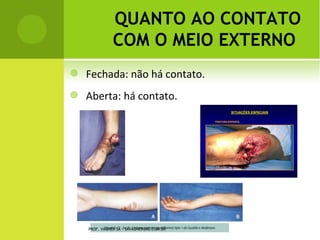 Â NGULO F ERGUSON




PROF. VAGNER SÁ - SAVAGNER@IG.COM.BR
 