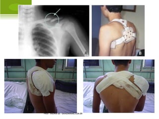 A USÊNCIA C ONGÊNITA R ÁDIO




PROF. VAGNER SÁ - SAVAGNER@IG.COM.BR
 