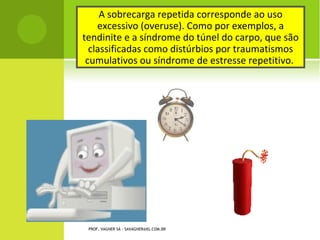 A sobrecarga repetida corresponde ao uso
    excessivo (overuse). Como por exemplos, a
tendinite e a síndrome do túnel do carpo, que são
 classificadas como distúrbios por traumatismos
 cumulativos ou síndrome de estresse repetitivo.




 PROF. VAGNER SÁ - SAVAGNER@IG.COM.BR
 