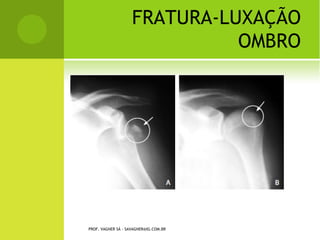 B ANDA DE C ONSTRICÇÃO




ARLINDO G. PARDINI JR. ACTA ORTOP BRAS 9(2) - ABR/JUN, 2001
                  PROF. VAGNER SÁ - SAVAGNER@IG.COM.BR
 