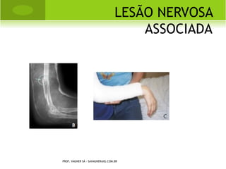 S INDACTILIA S IMPLES




PROF. VAGNER SÁ - SAVAGNER@IG.COM.BR
 