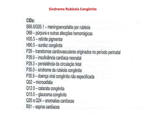 Síndrome Rubéola Congênita
 
