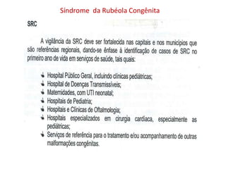 Síndrome da Rubéola Congênita
 