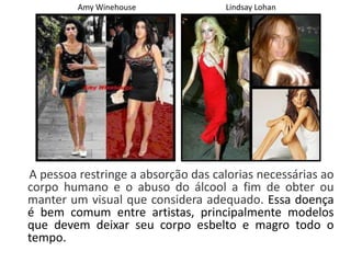 A pessoa restringe a absorção das calorias necessárias ao
corpo humano e o abuso do álcool a fim de obter ou
manter um visual que considera adequado. Essa doença
é bem comum entre artistas, principalmente modelos
que devem deixar seu corpo esbelto e magro todo o
tempo.
Amy Winehouse Lindsay Lohan
 