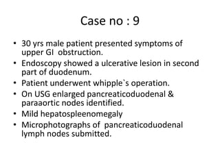 Case no : 9
• 30 yrs male patient presented symptoms of
upper GI obstruction.
• Endoscopy showed a ulcerative lesion in second
part of duodenum.
• Patient underwent whipple`s operation.
• On USG enlarged pancreaticoduodenal &
paraaortic nodes identified.
• Mild hepatospleenomegaly
• Microphotographs of pancreaticoduodenal
lymph nodes submitted.