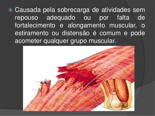 Absurdo da pessoa em pigmentação