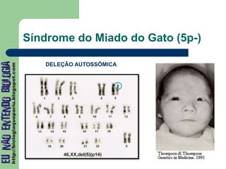 Síndrome do Miado do Gato (5p-)
DELEÇÃO AUTOSSÔMICA
 