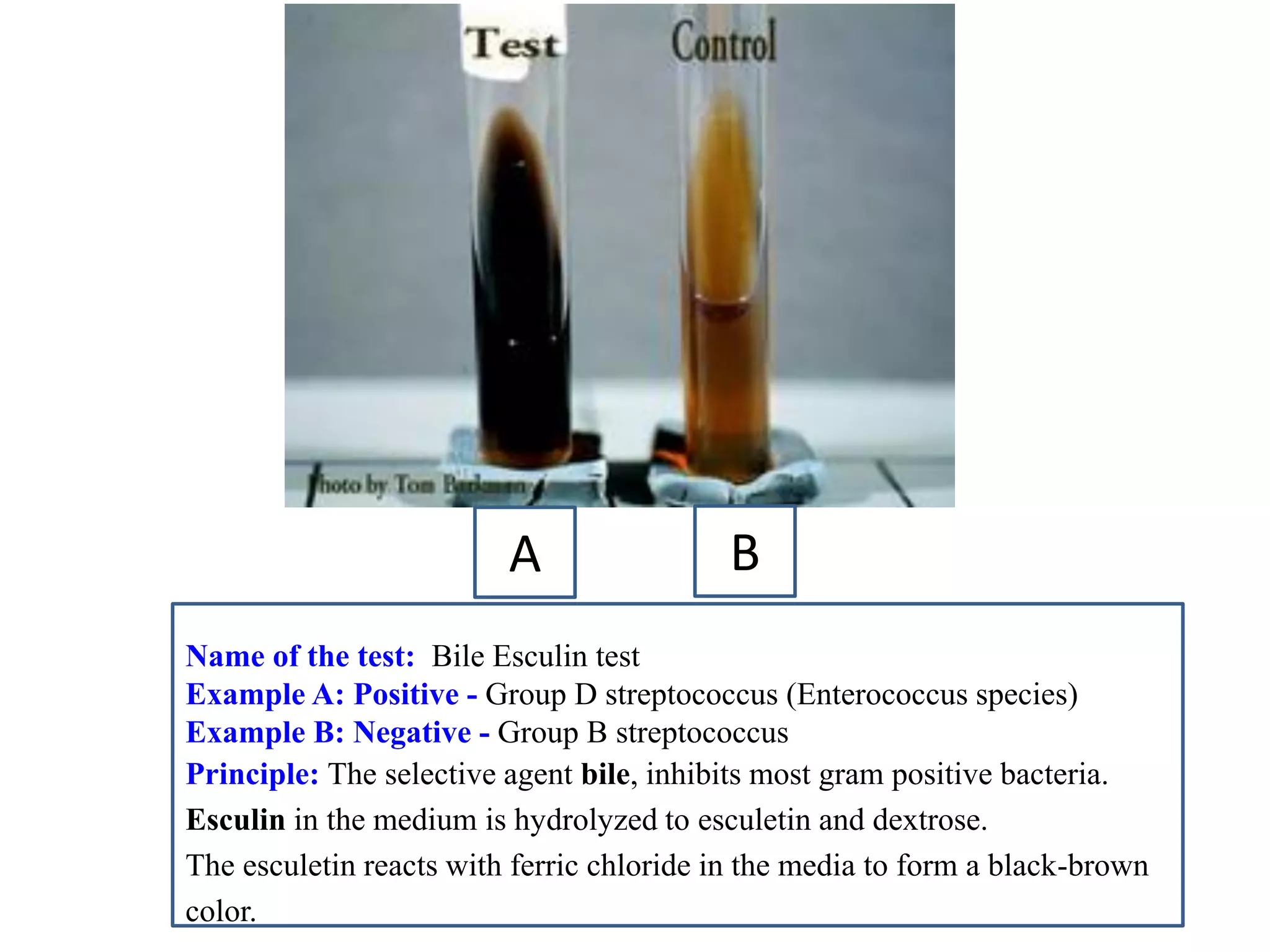 A 
B 
Name of the test: Bile Esculin test 
Example A: Positive - Group D streptococcus (Enterococcus species) 
Example B: Negative - Group B streptococcus 
Principle: The selective agent bile, inhibits most gram positive bacteria. 
Esculin in the medium is hydrolyzed to esculetin and dextrose. 
The esculetin reacts with ferric chloride in the media to form a black-brown color.  