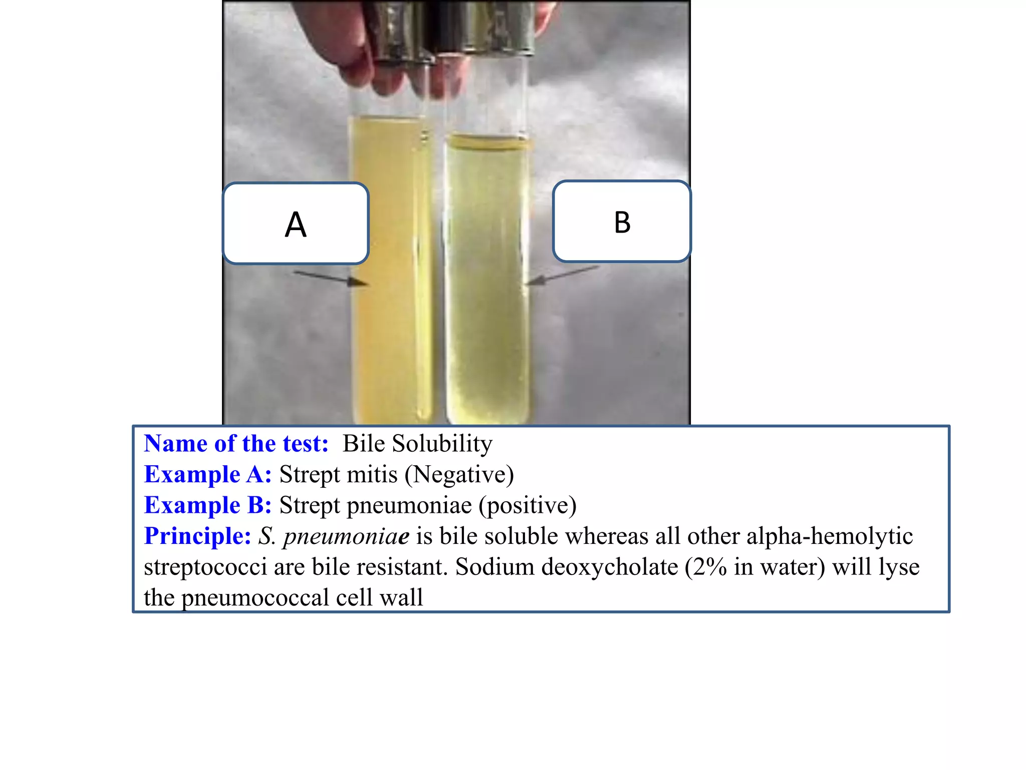 B 
A 
Name of the test: Bile Solubility 
Example A: Strept mitis (Negative) 
Example B: Strept pneumoniae (positive) 
Principle: S. pneumoniae is bile soluble whereas all other alpha-hemolytic streptococci are bile resistant. Sodium deoxycholate (2% in water) will lyse the pneumococcal cell wall  