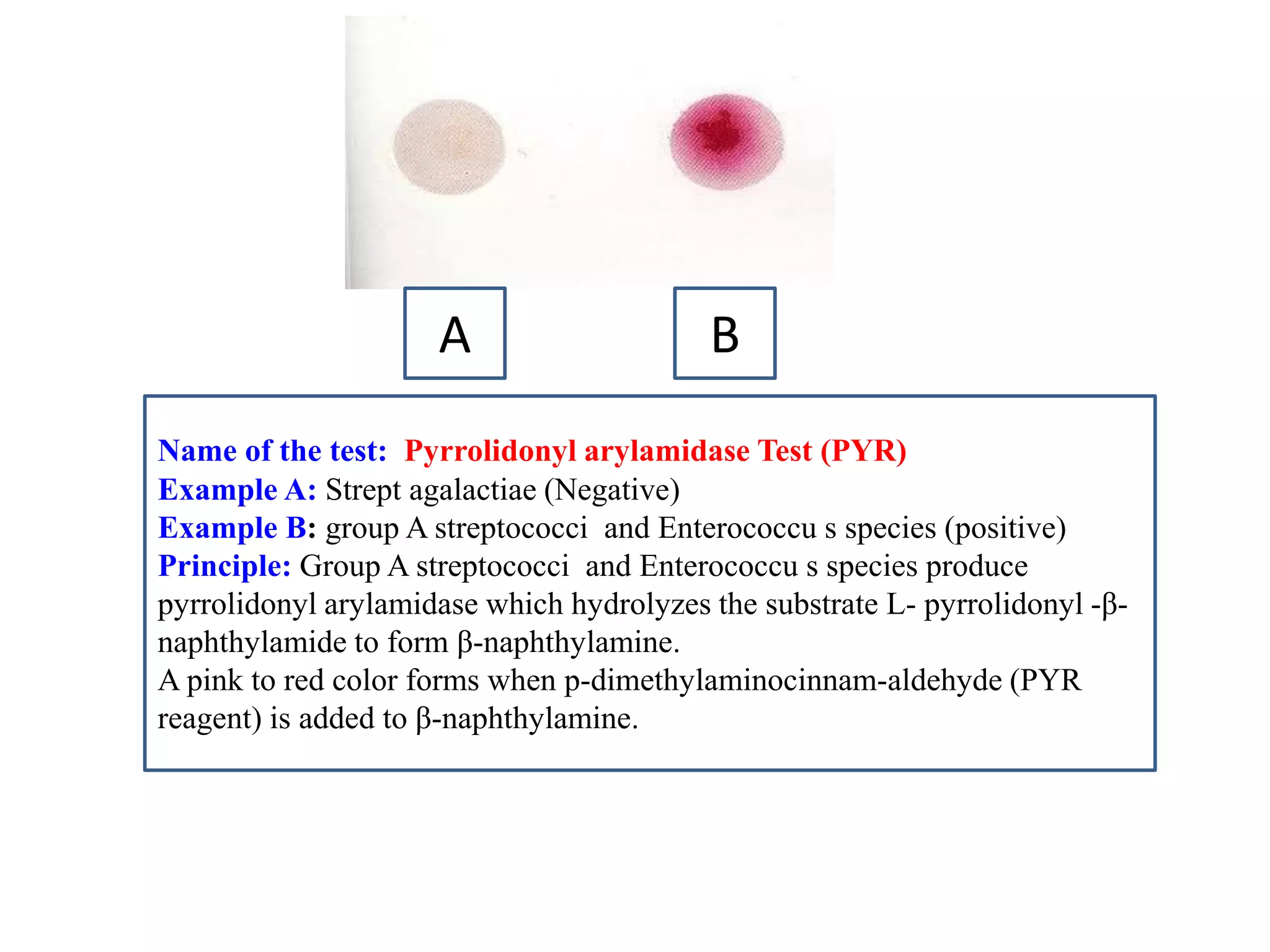 A 
B 
Name of the test: Pyrrolidonyl arylamidase Test (PYR) 
Example A: Strept agalactiae (Negative) 
Example B: group A streptococci and Enterococcu s species (positive) 
Principle: Group A streptococci and Enterococcu s species produce pyrrolidonyl arylamidase which hydrolyzes the substrate L- pyrrolidonyl -β- naphthylamide to form β-naphthylamine. 
A pink to red color forms when p-dimethylaminocinnam-aldehyde (PYR reagent) is added to β-naphthylamine.  