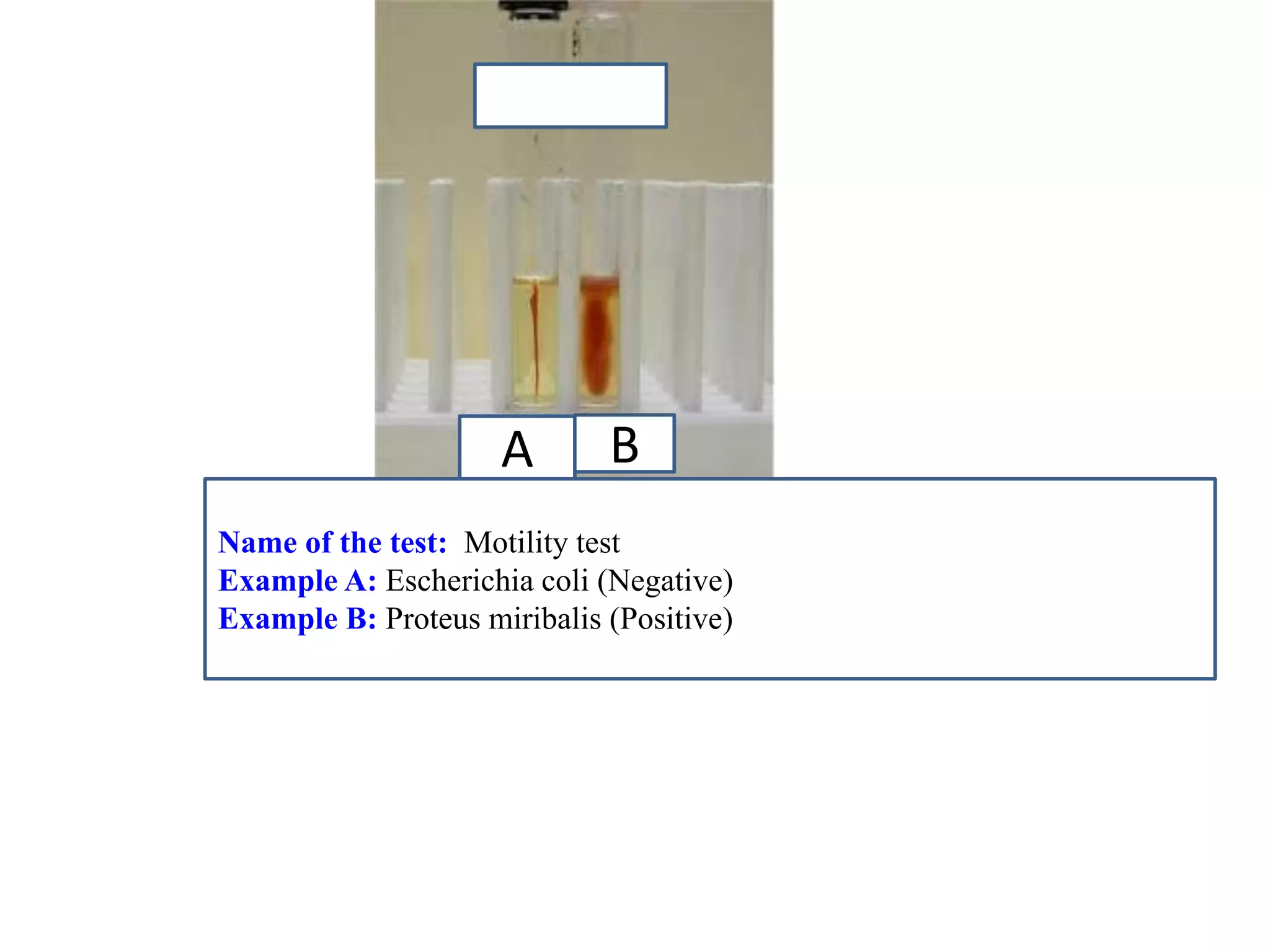 A 
B 
Name of the test: Motility test 
Example A: Escherichia coli (Negative) 
Example B: Proteus miribalis (Positive)  