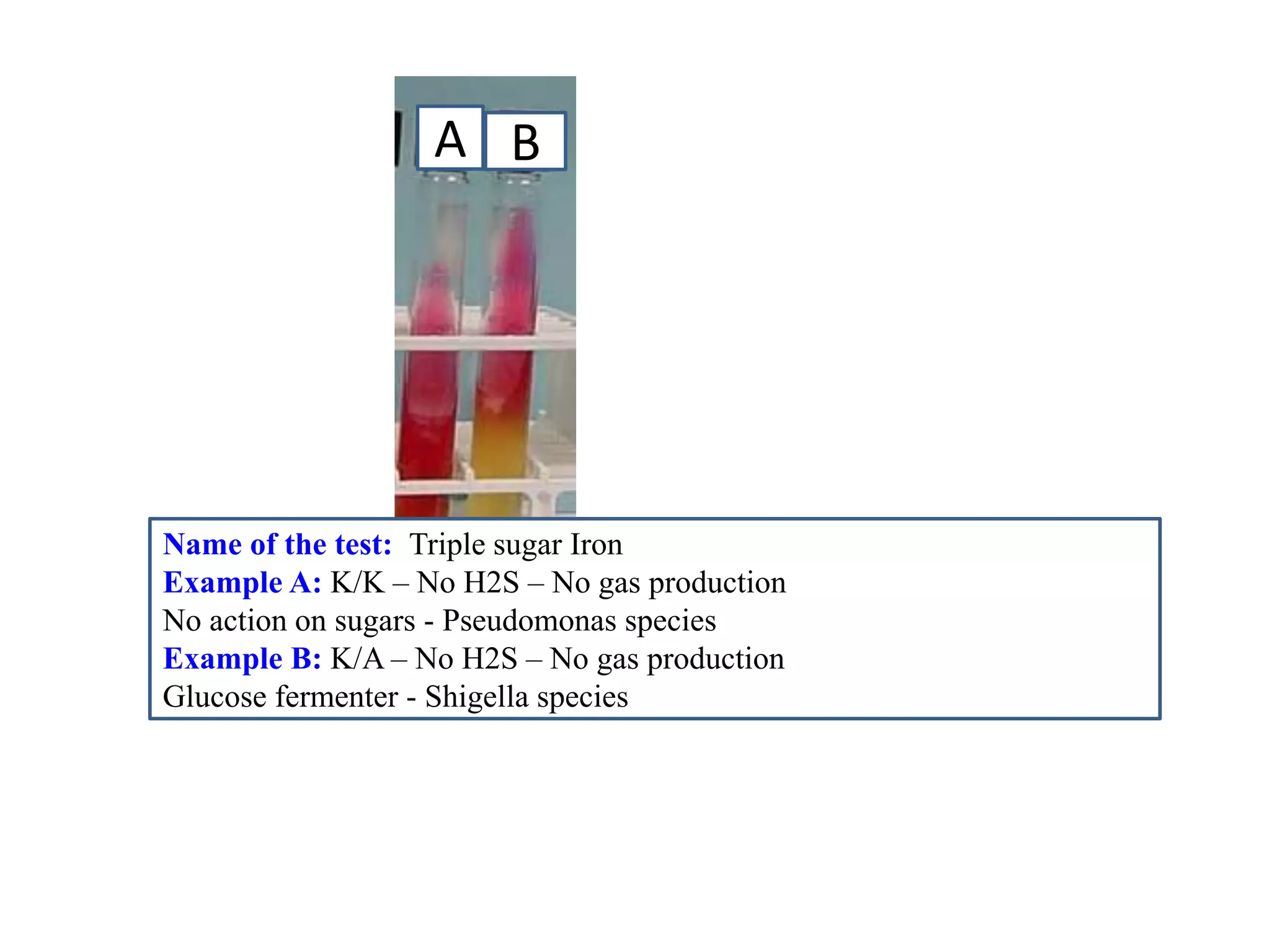 A 
B 
Name of the test: Triple sugar Iron 
Example A: K/K – No H2S – No gas production 
No action on sugars - Pseudomonas species 
Example B: K/A – No H2S – No gas production 
Glucose fermenter - Shigella species  