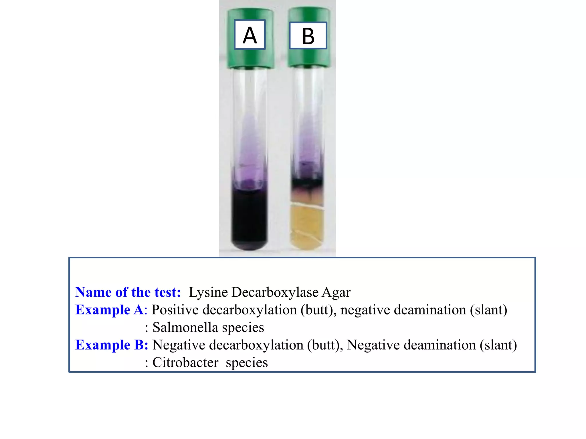 A 
B 
Name of the test: Lysine Decarboxylase Agar 
Example A: Positive decarboxylation (butt), negative deamination (slant) 
: Salmonella species 
Example B: Negative decarboxylation (butt), Negative deamination (slant) 
: Citrobacter species 
 