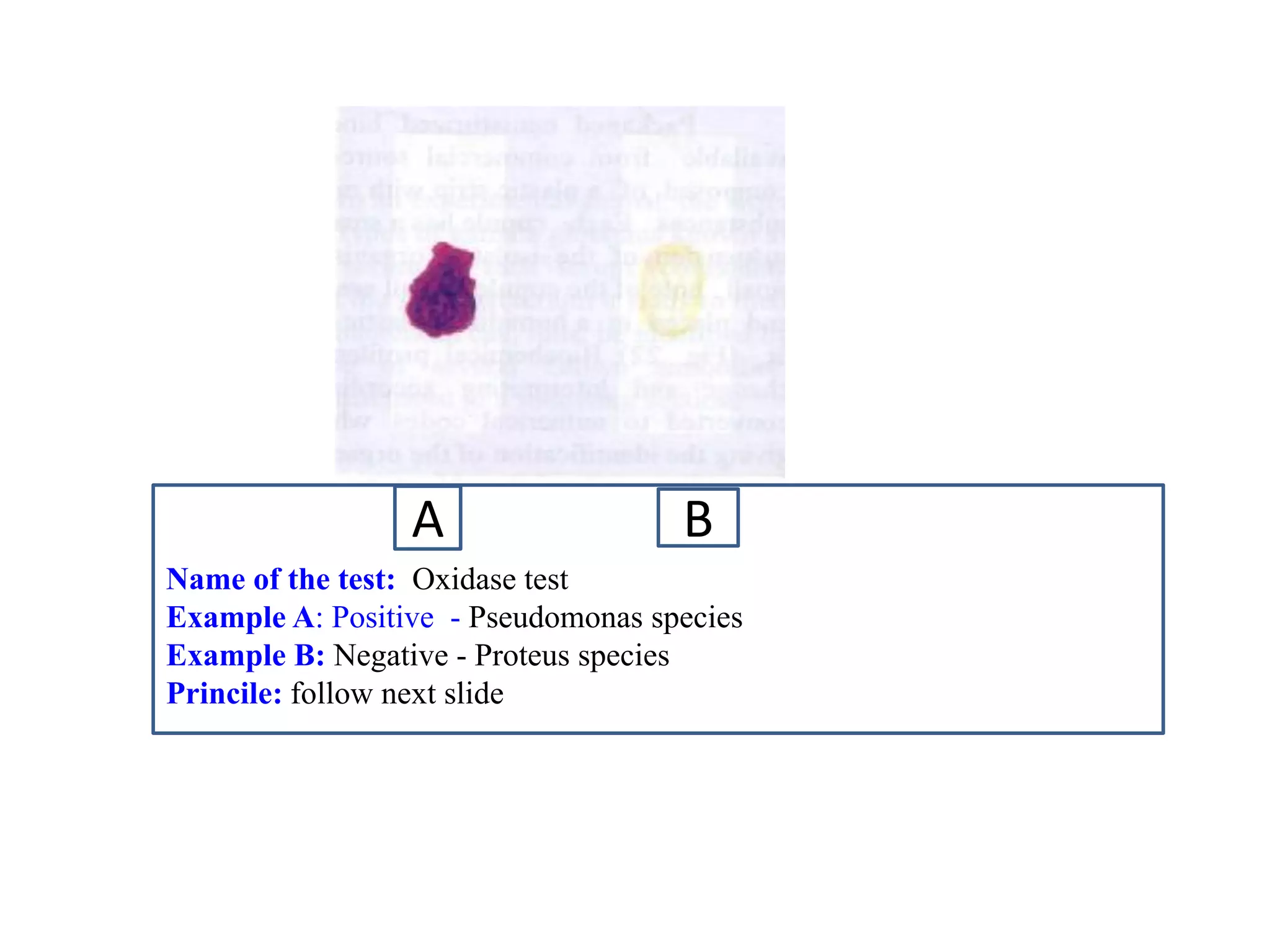 Name of the test: Oxidase test 
Example A: Positive - Pseudomonas species 
Example B: Negative - Proteus species 
Princile: follow next slide 
A 
B  