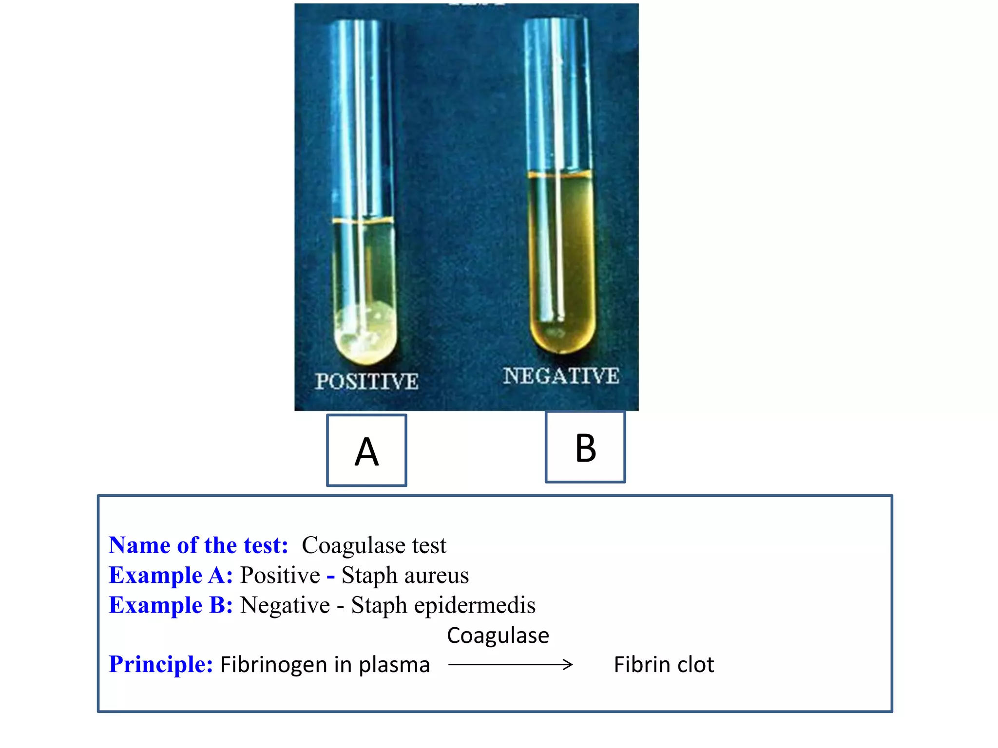 A 
B 
Name of the test: Coagulase test 
Example A: Positive - Staph aureus 
Example B: Negative - Staph epidermedis 
Principle: Fibrinogen in plasma Fibrin clot 
Coagulase  