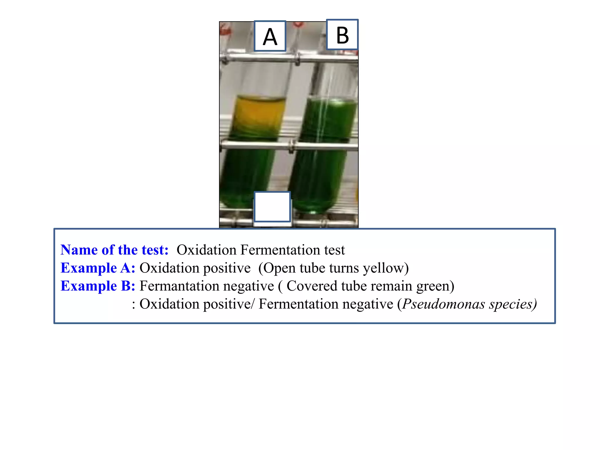A 
B 
Name of the test: Oxidation Fermentation test 
Example A: Oxidation positive (Open tube turns yellow) 
Example B: Fermantation negative ( Covered tube remain green) 
: Oxidation positive/ Fermentation negative (Pseudomonas species) 
 