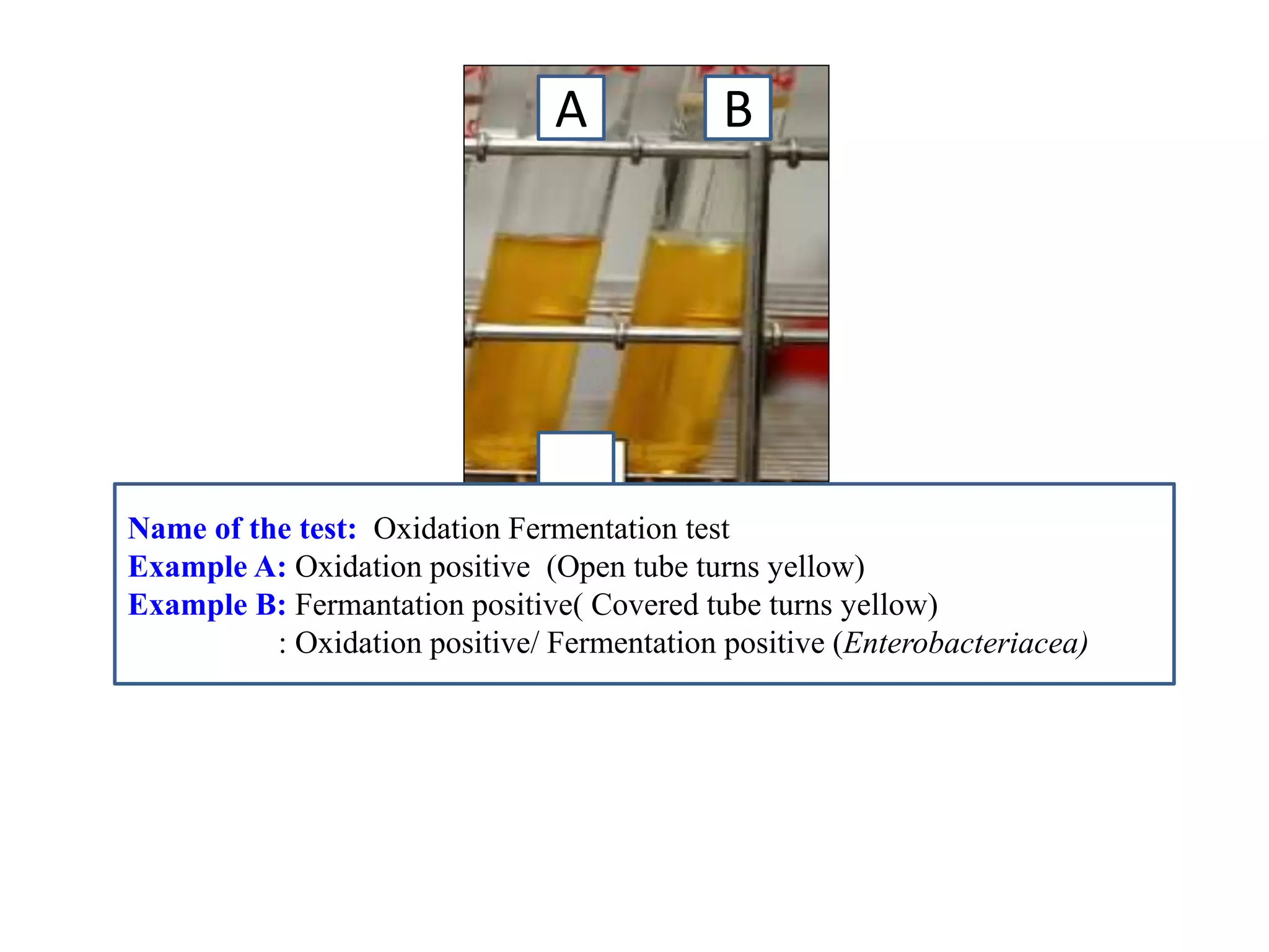 A 
B 
Name of the test: Oxidation Fermentation test 
Example A: Oxidation positive (Open tube turns yellow) 
Example B: Fermantation positive( Covered tube turns yellow) 
: Oxidation positive/ Fermentation positive (Enterobacteriacea) 
 