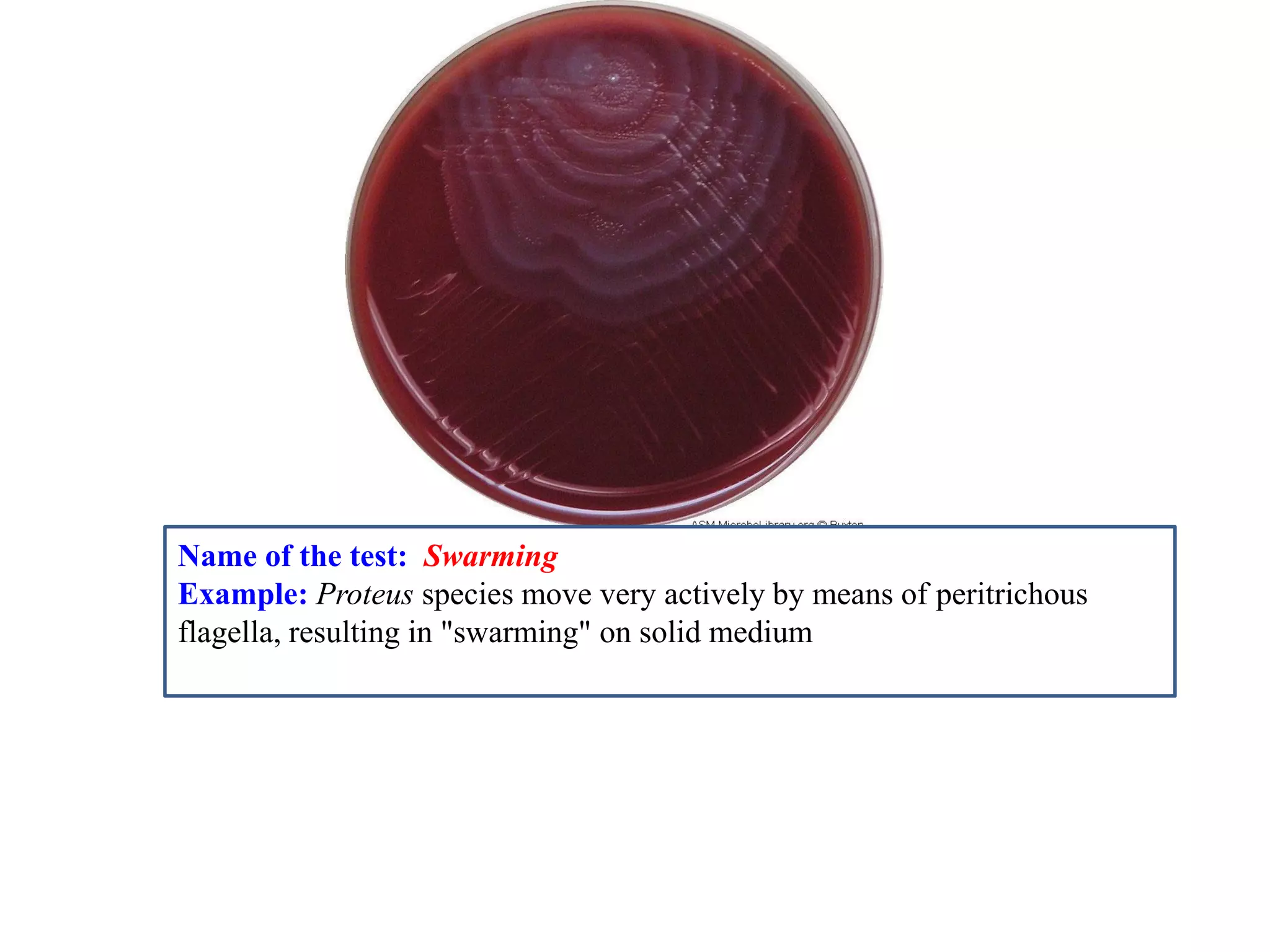Name of the test: Swarming 
Example: Proteus species move very actively by means of peritrichous flagella, resulting in "swarming" on solid medium 
 