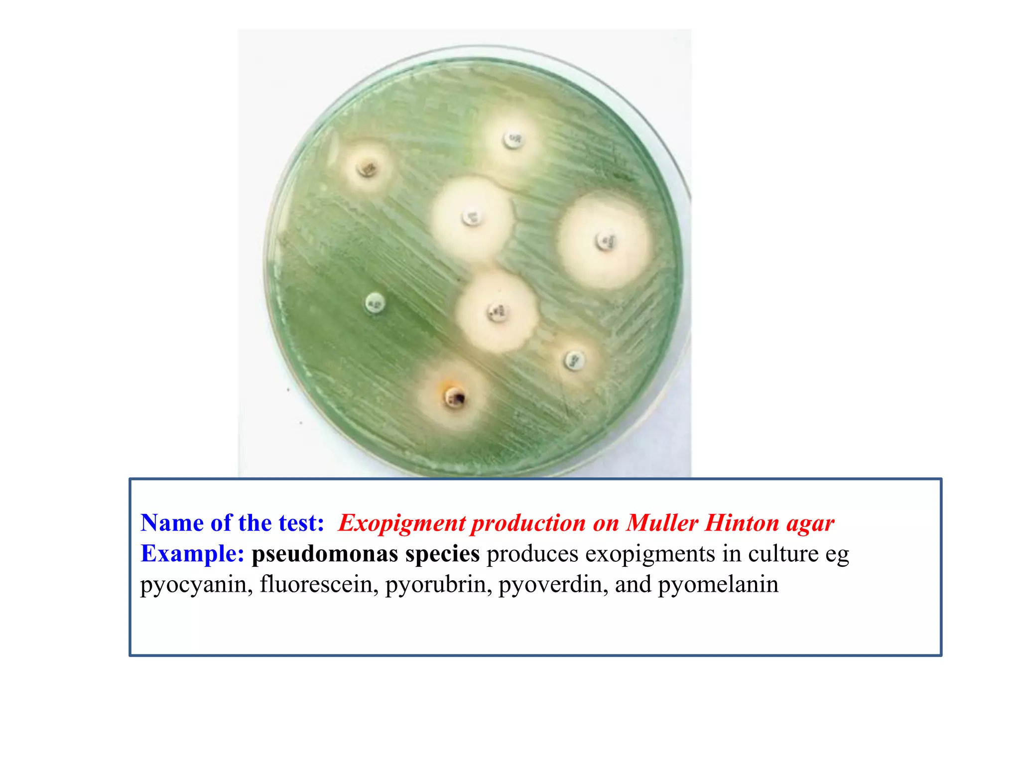 Name of the test: Exopigment production on Muller Hinton agar 
Example: pseudomonas species produces exopigments in culture eg pyocyanin, fluorescein, pyorubrin, pyoverdin, and pyomelanin 
 