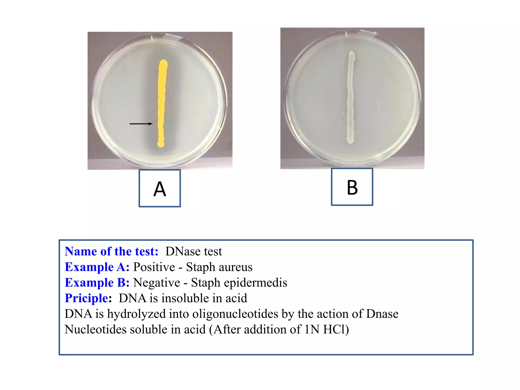 A 
B 
Name of the test: DNase test 
Example A: Positive - Staph aureus 
Example B: Negative - Staph epidermedis 
Priciple: DNA is insoluble in acid 
DNA is hydrolyzed into oligonucleotides by the action of Dnase 
Nucleotides soluble in acid (After addition of 1N HCl) 
 