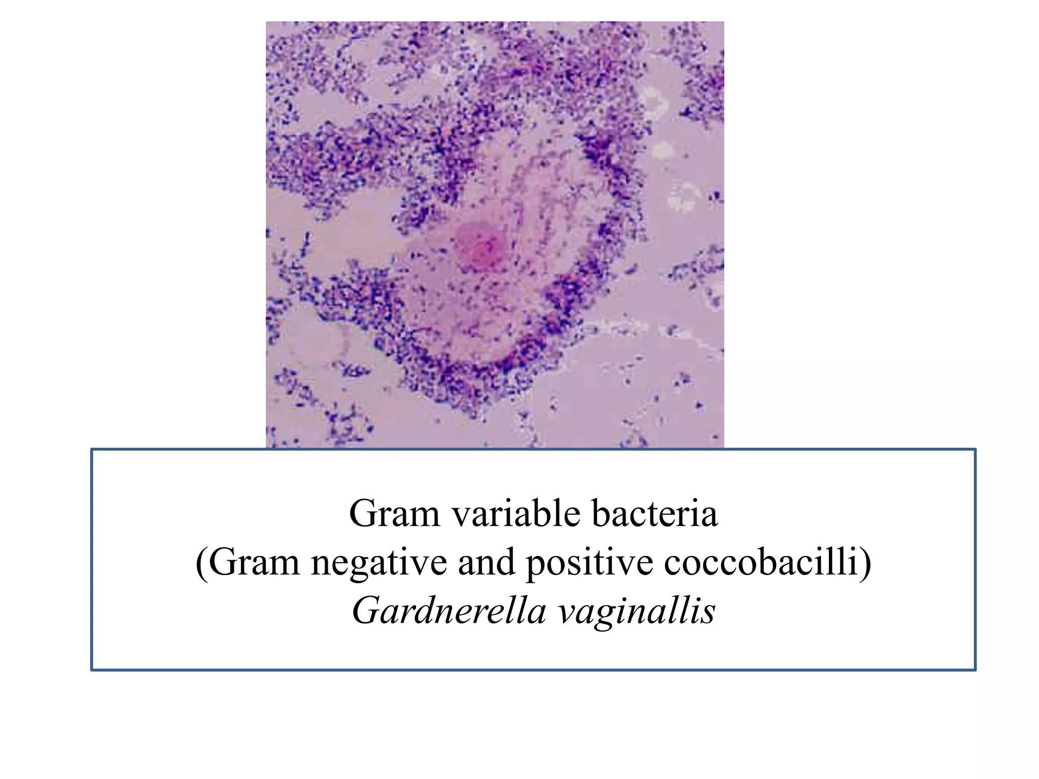 Gram variable bacteria 
(Gram negative and positive coccobacilli) 
Gardnerella vaginallis  