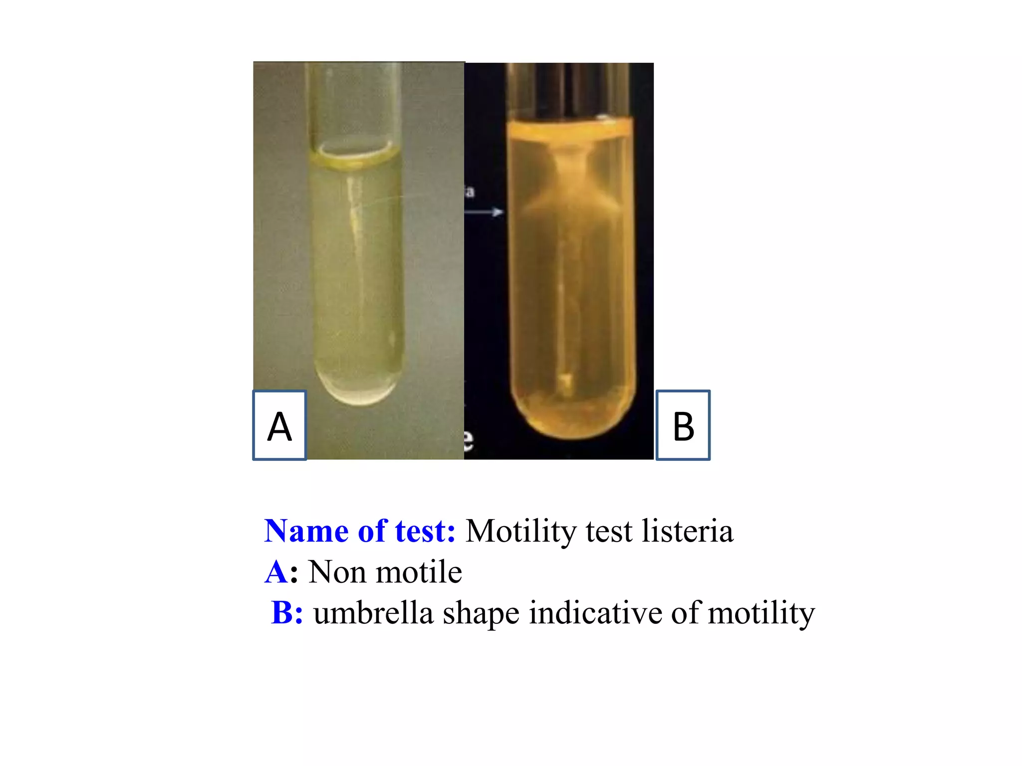 Name of test: Motility test listeria 
A: Non motile 
B: umbrella shape indicative of motility 
A 
B  