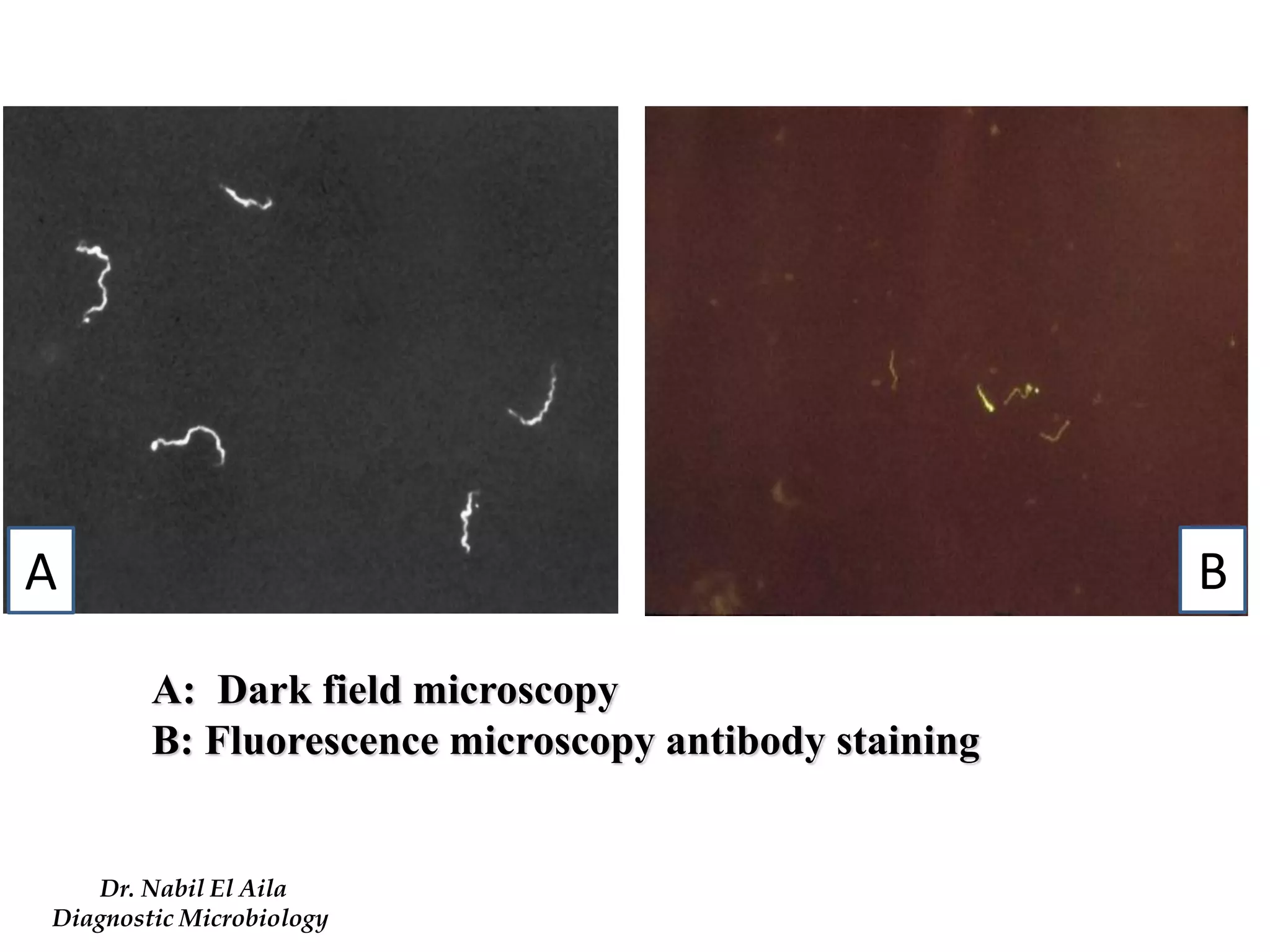 A: Dark field microscopy 
B: Fluorescence microscopy antibody staining 
Dr. Nabil El Aila 
Diagnostic Microbiology 
A 
B  