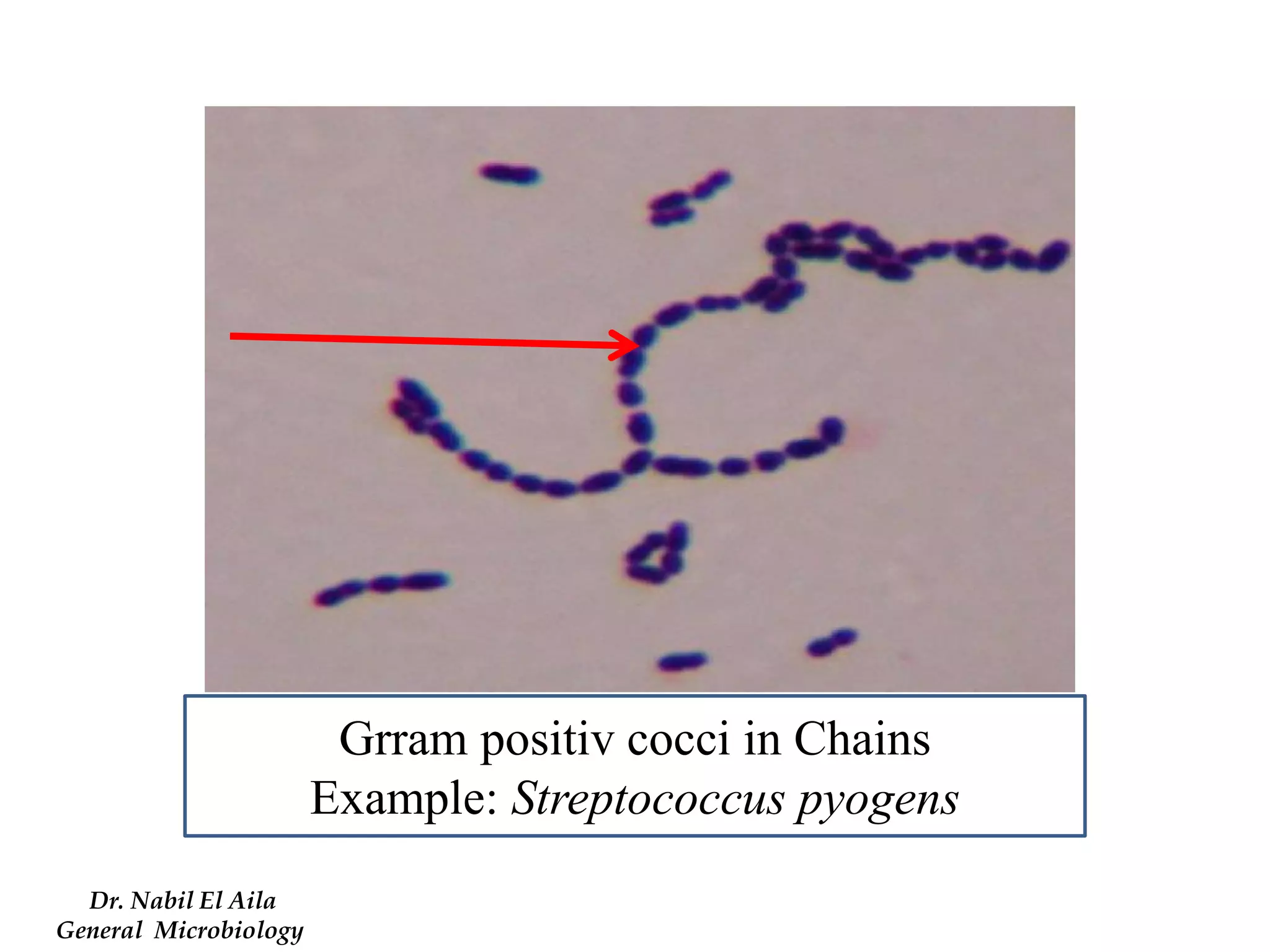 Grram positiv cocci in Chains 
Example: Streptococcus pyogens 
Dr. Nabil El Aila 
General Microbiology  