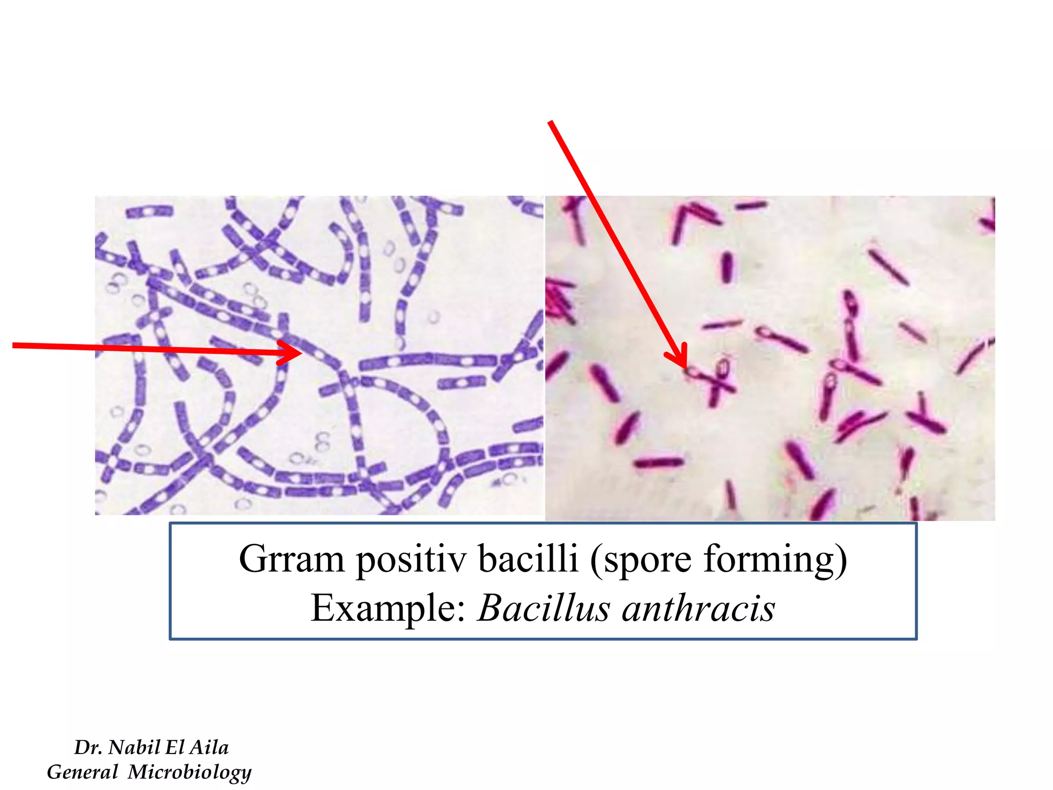 Grram positiv bacilli (spore forming) 
Example: Bacillus anthracis 
Dr. Nabil El Aila 
General Microbiology  