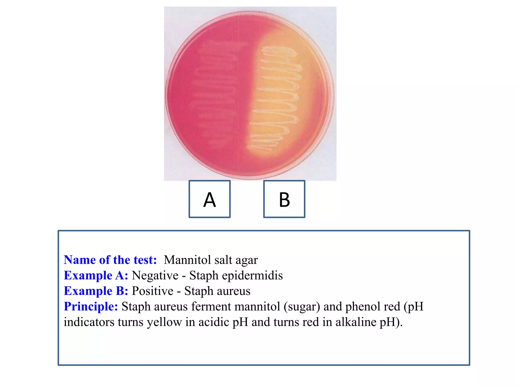 Name of the test: Mannitol salt agar 
Example A: Negative - Staph epidermidis 
Example B: Positive - Staph aureus 
Principle: Staph aureus ferment mannitol (sugar) and phenol red (pH indicators turns yellow in acidic pH and turns red in alkaline pH). 
A 
B  