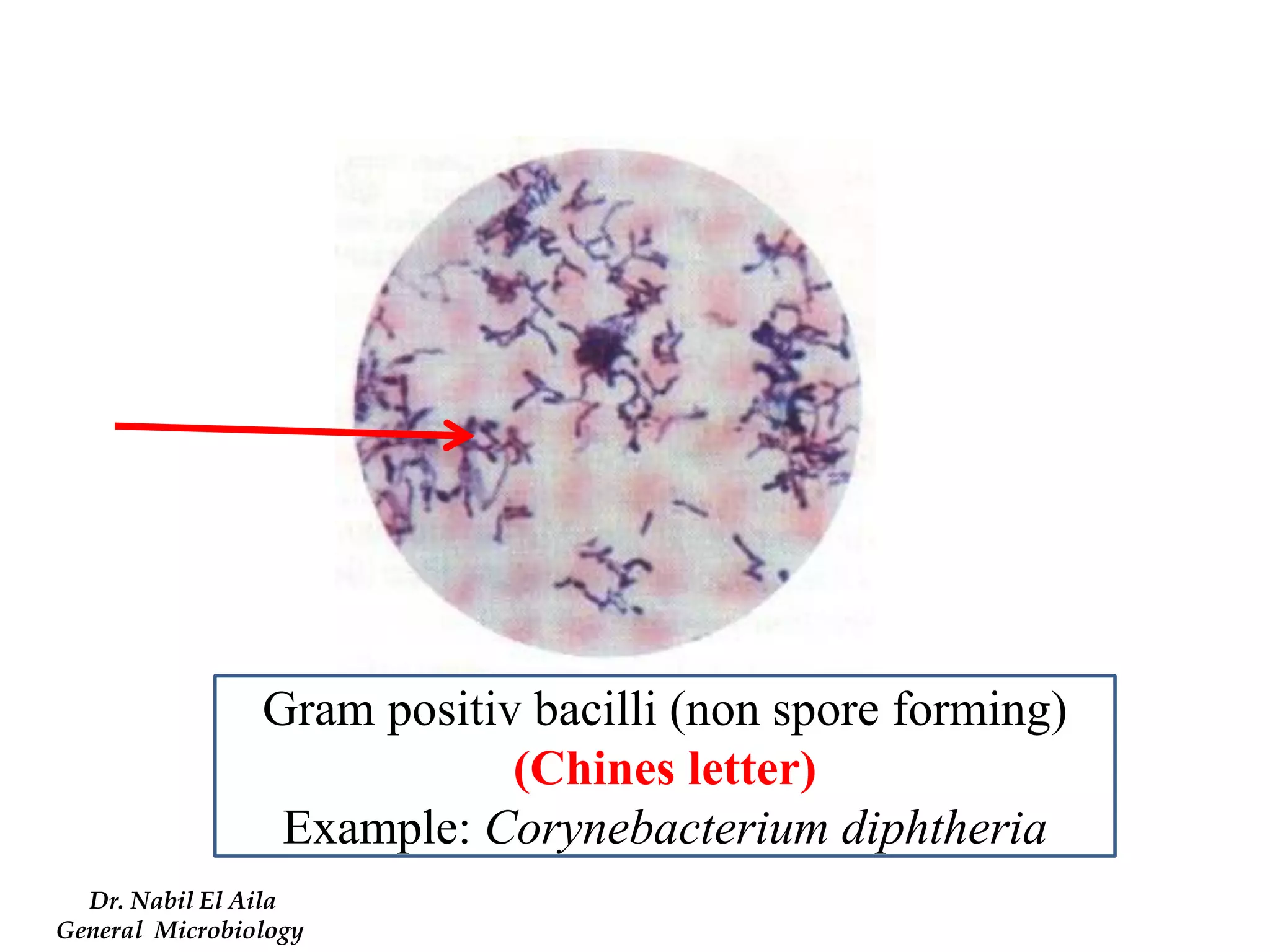 Gram positiv bacilli (non spore forming) (Chines letter) 
Example: Corynebacterium diphtheria 
Dr. Nabil El Aila 
General Microbiology  
