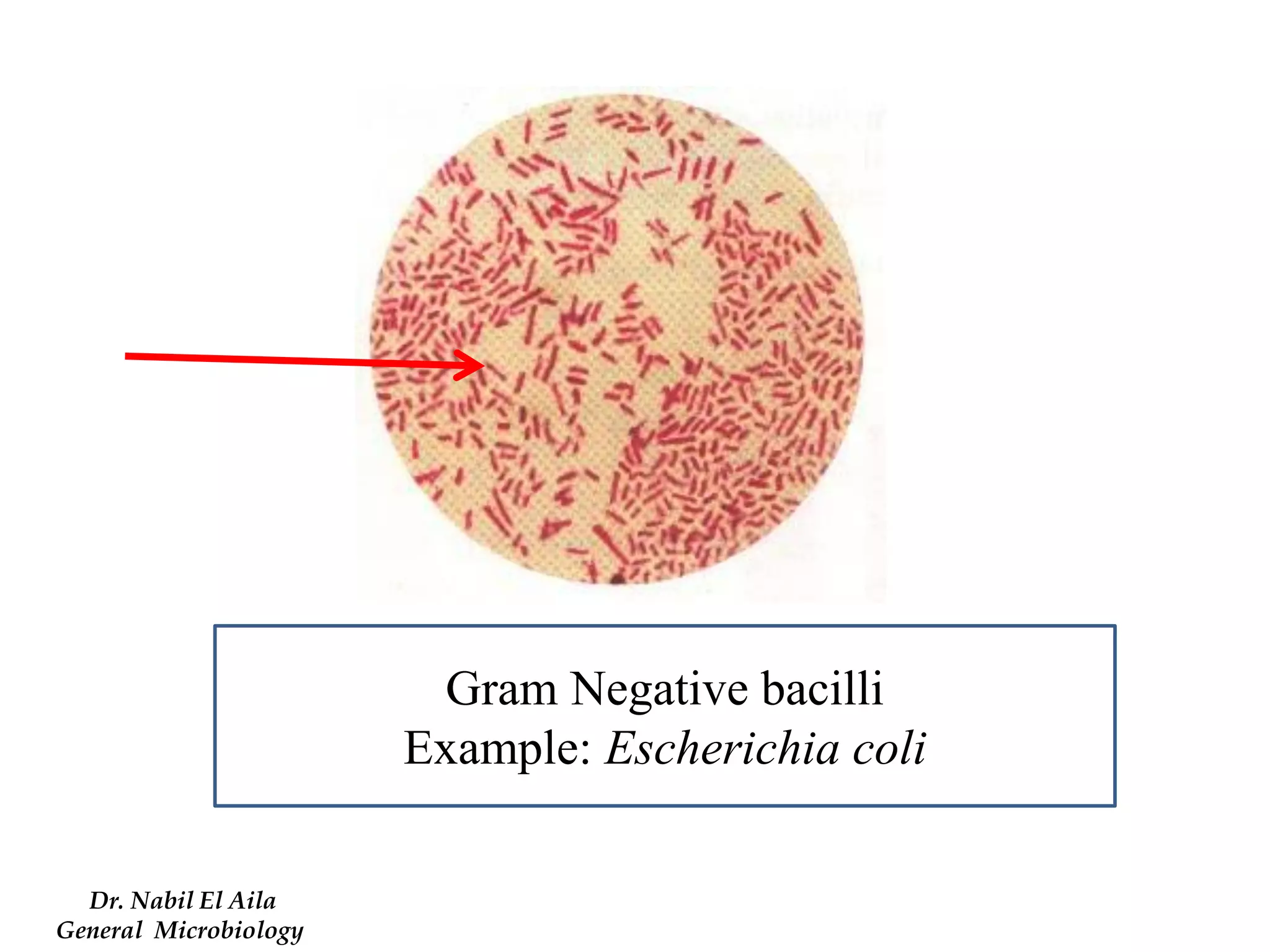 Gram Negative bacilli 
Example: Escherichia coli 
Dr. Nabil El Aila 
General Microbiology  