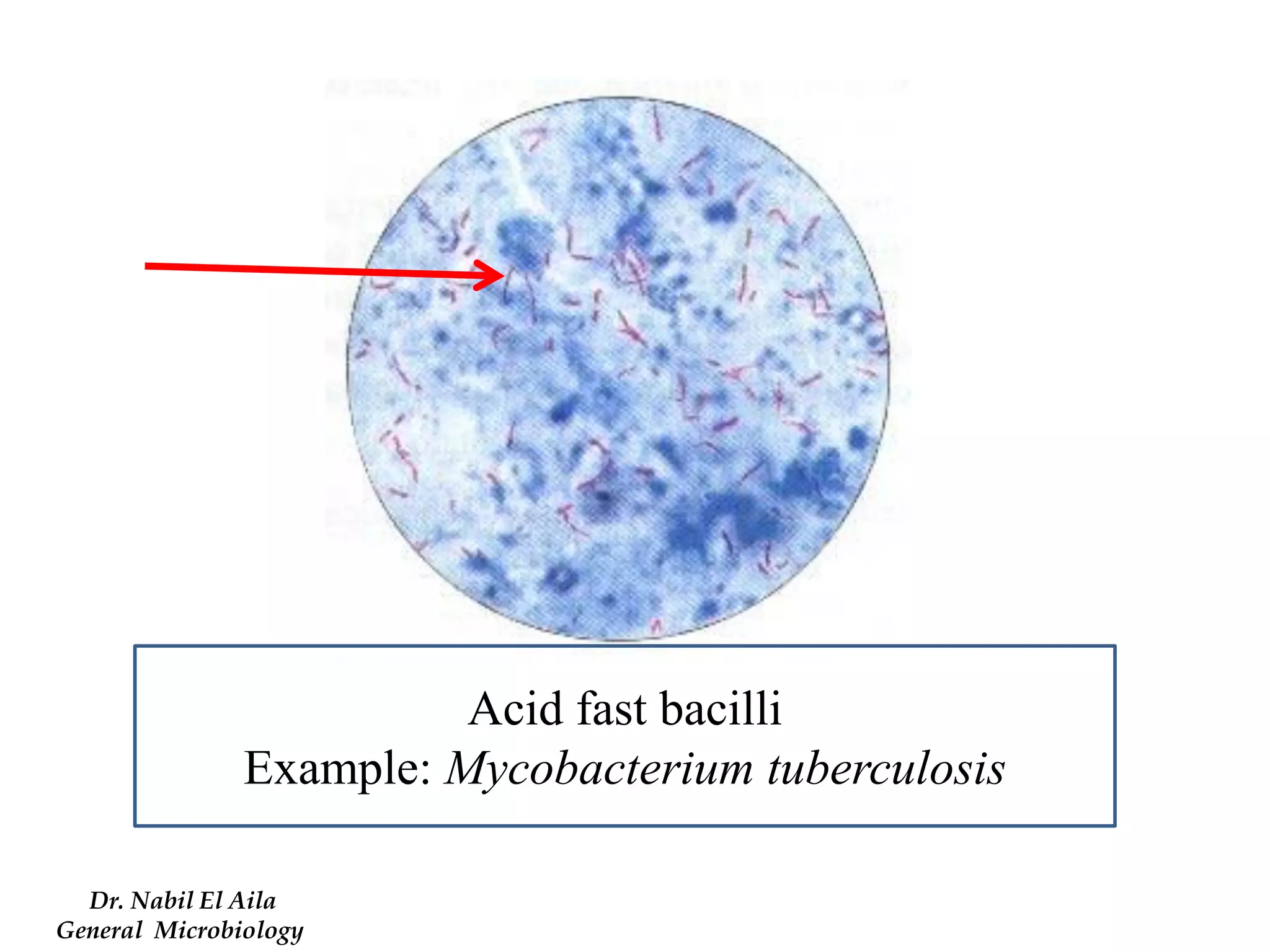 Acid fast bacilli 
Example: Mycobacterium tuberculosis 
Dr. Nabil El Aila 
General Microbiology  