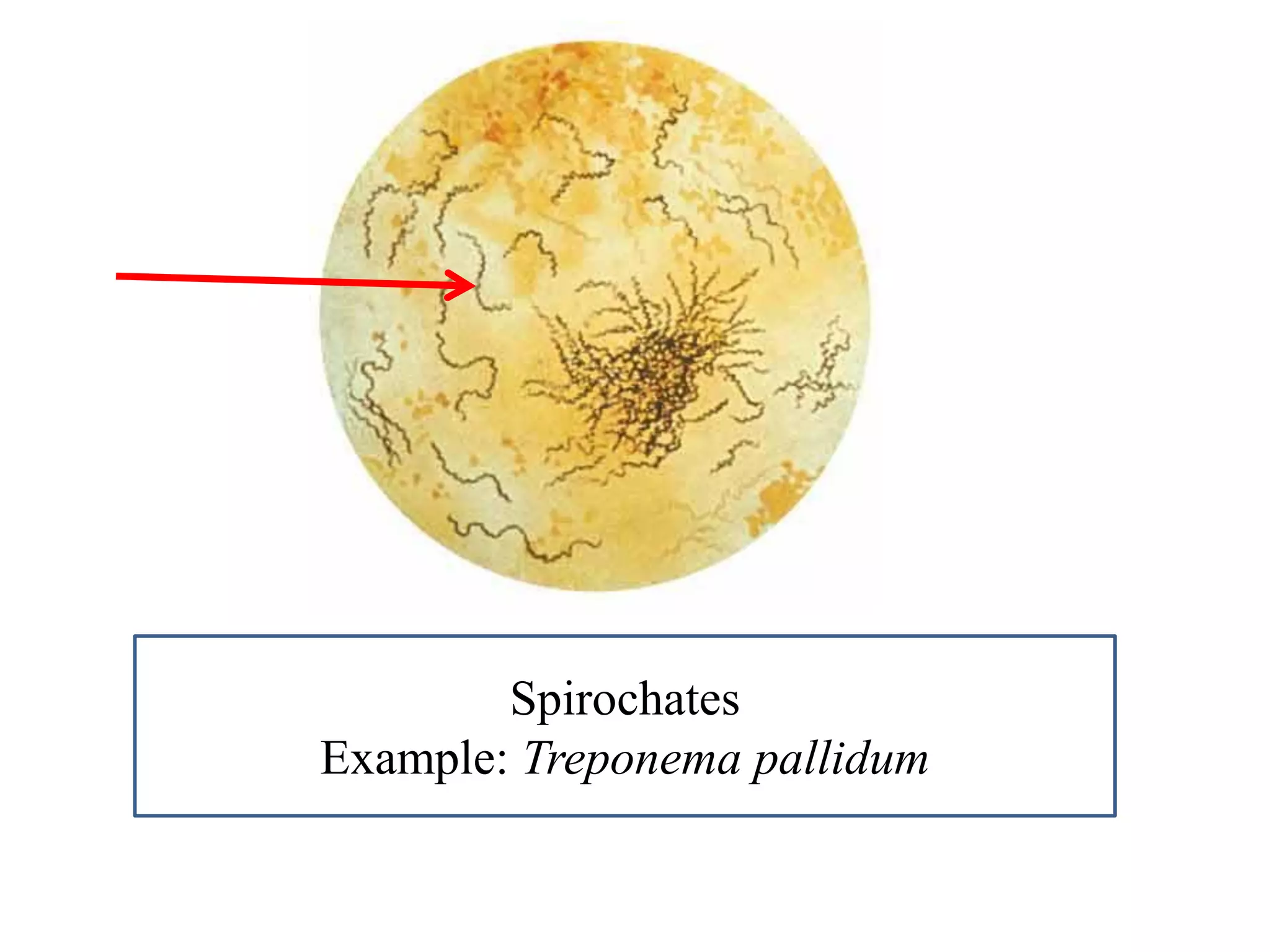 Spirochates 
Example: Treponema pallidum  