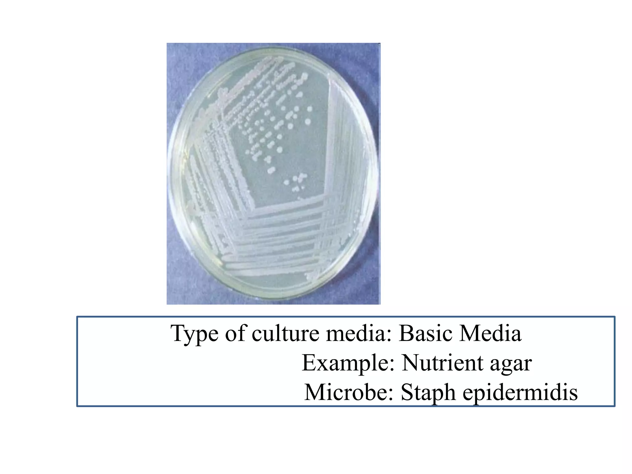 Type of culture media: Basic Media 
Example: Nutrient agar 
Microbe: Staph epidermidis  