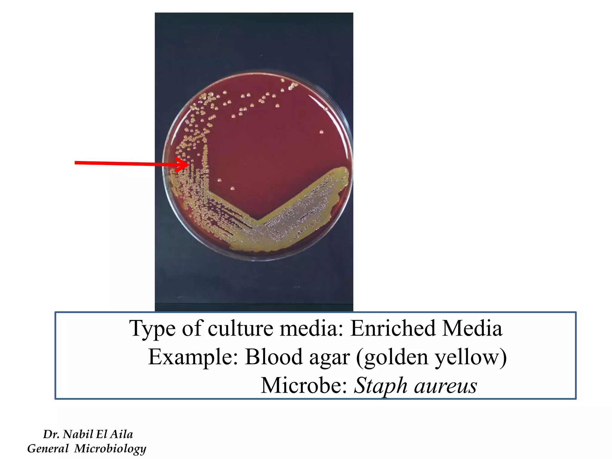 Type of culture media: Enriched Media 
Example: Blood agar (golden yellow) 
Microbe: Staph aureus 
Dr. Nabil El Aila 
General Microbiology  