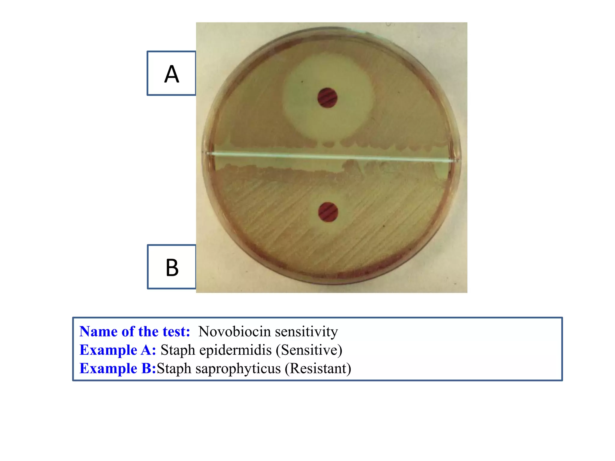 Name of the test: Novobiocin sensitivity 
Example A: Staph epidermidis (Sensitive) 
Example B:Staph saprophyticus (Resistant) 
A 
B  