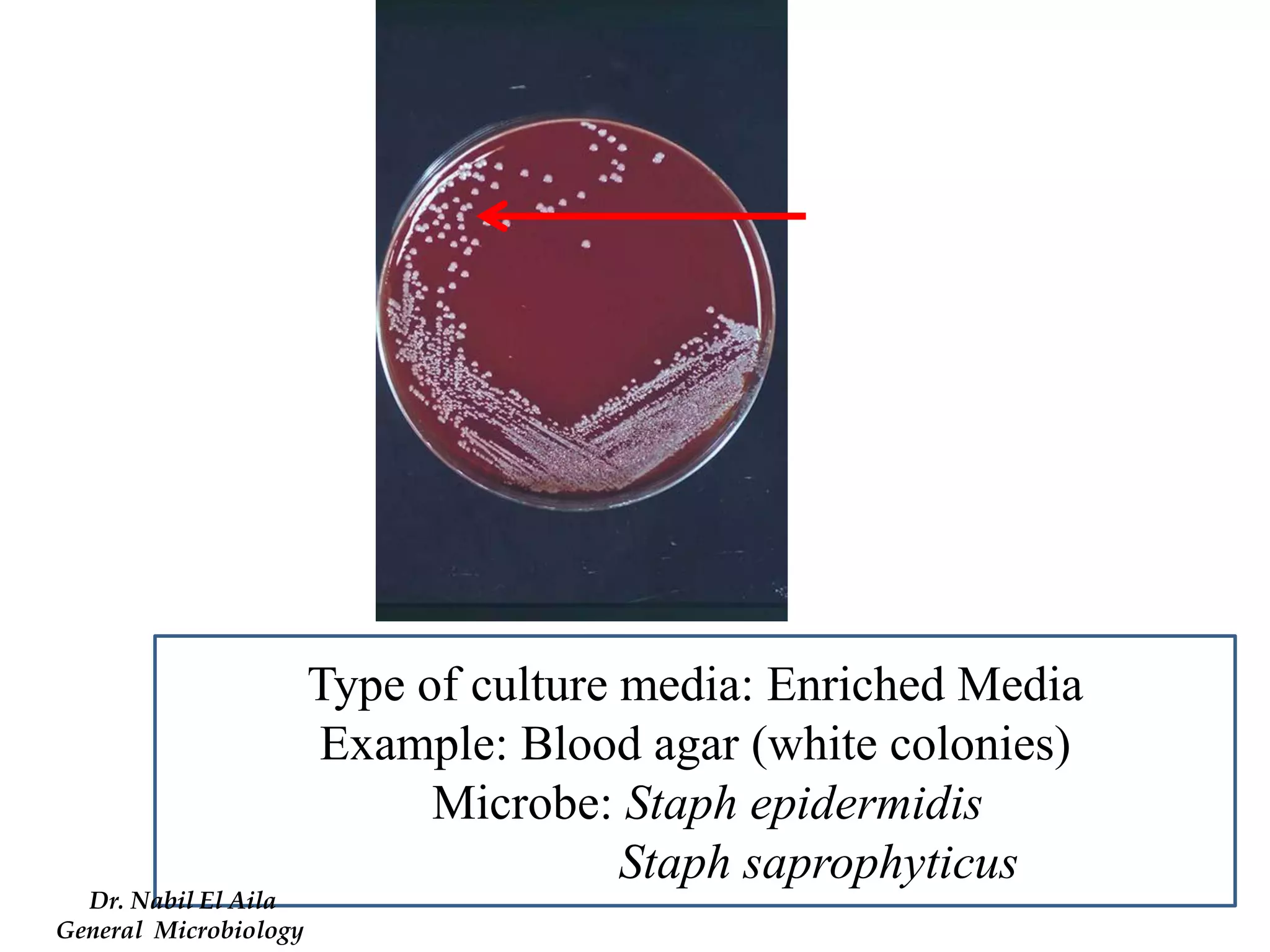 Type of culture media: Enriched Media 
Example: Blood agar (white colonies) 
Microbe: Staph epidermidis 
Staph saprophyticus 
Dr. Nabil El Aila 
General Microbiology  