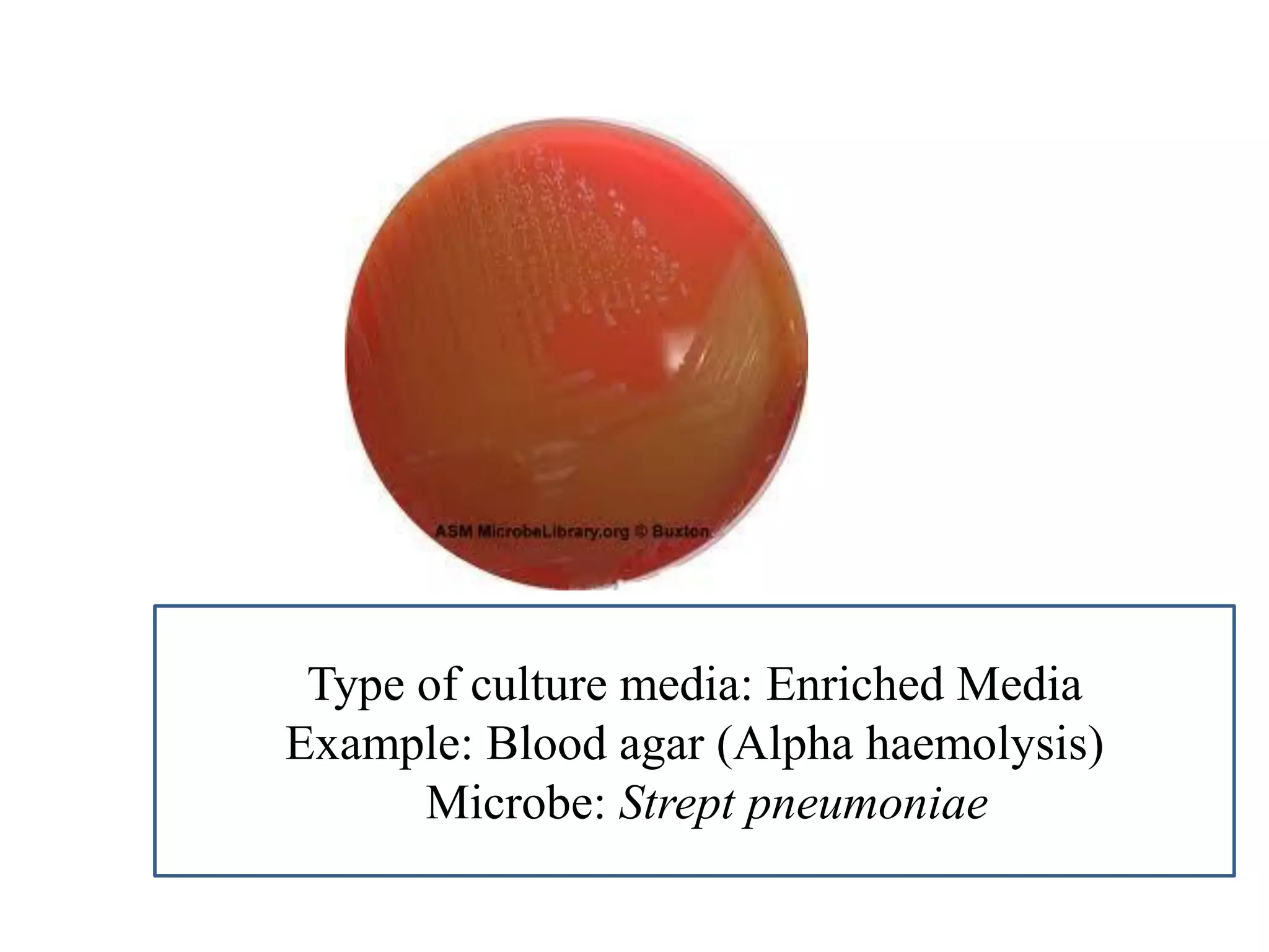 Type of culture media: Enriched Media 
Example: Blood agar (Alpha haemolysis) 
Microbe: Strept pneumoniae  