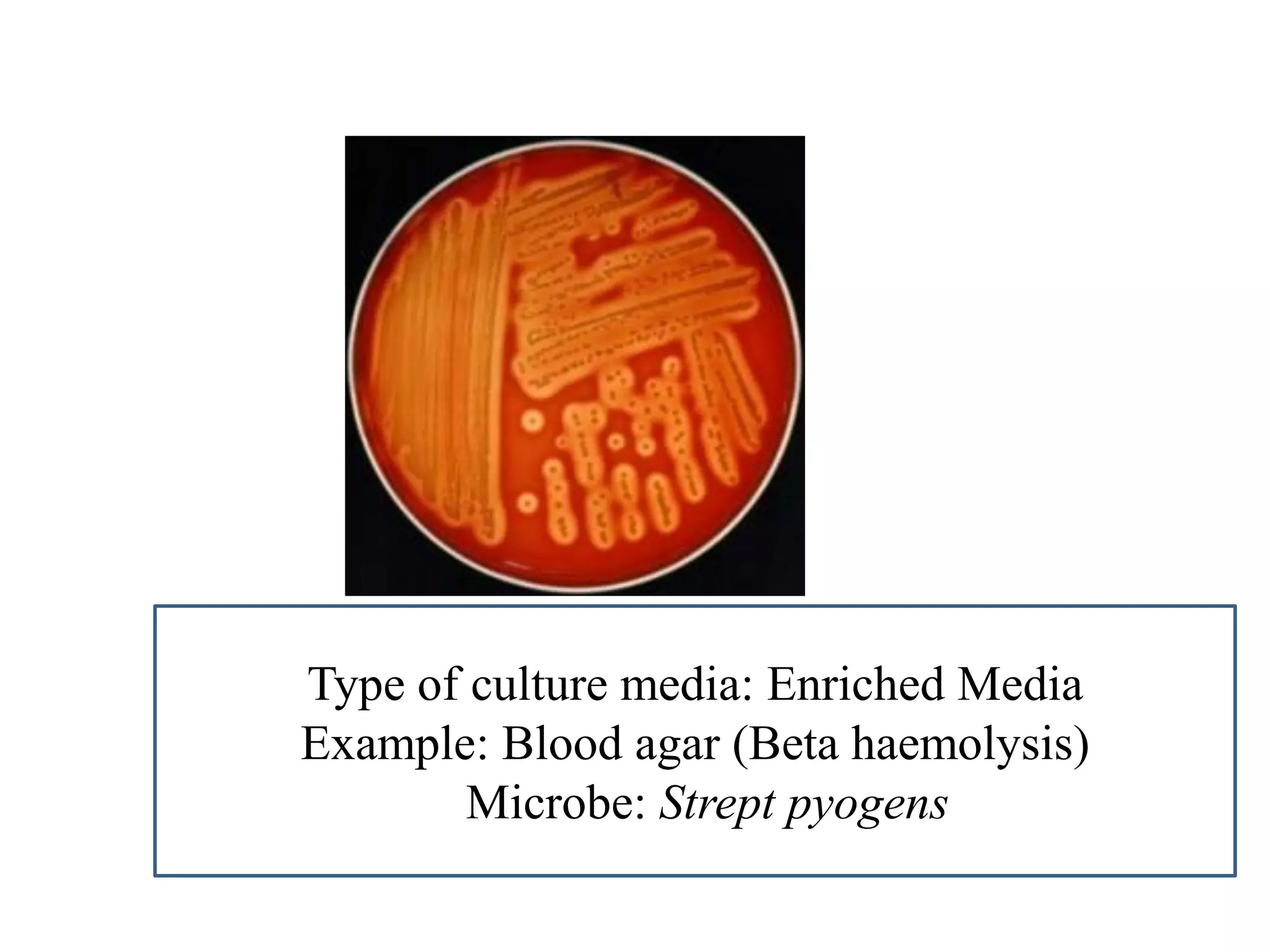 Type of culture media: Enriched Media 
Example: Blood agar (Beta haemolysis) 
Microbe: Strept pyogens  