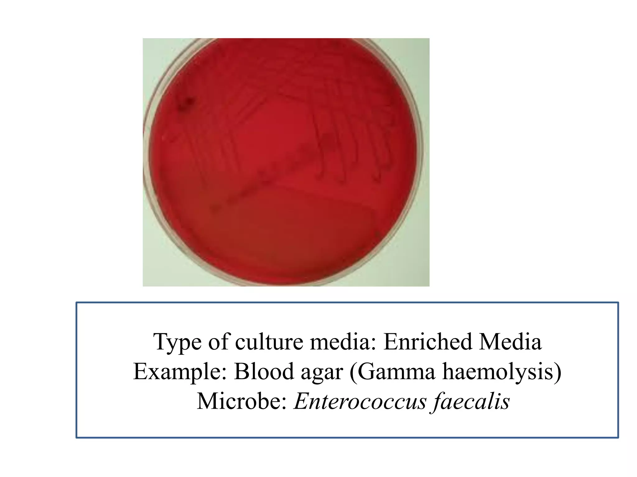 Type of culture media: Enriched Media 
Example: Blood agar (Gamma haemolysis) 
Microbe: Enterococcus faecalis  
