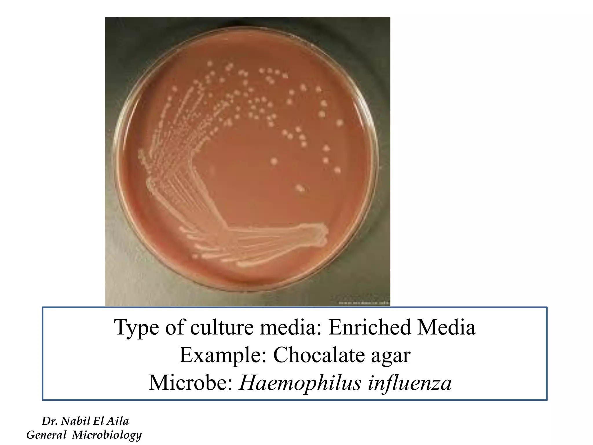 Type of culture media: Enriched Media 
Example: Chocalate agar 
Microbe: Haemophilus influenza 
Dr. Nabil El Aila 
General Microbiology  