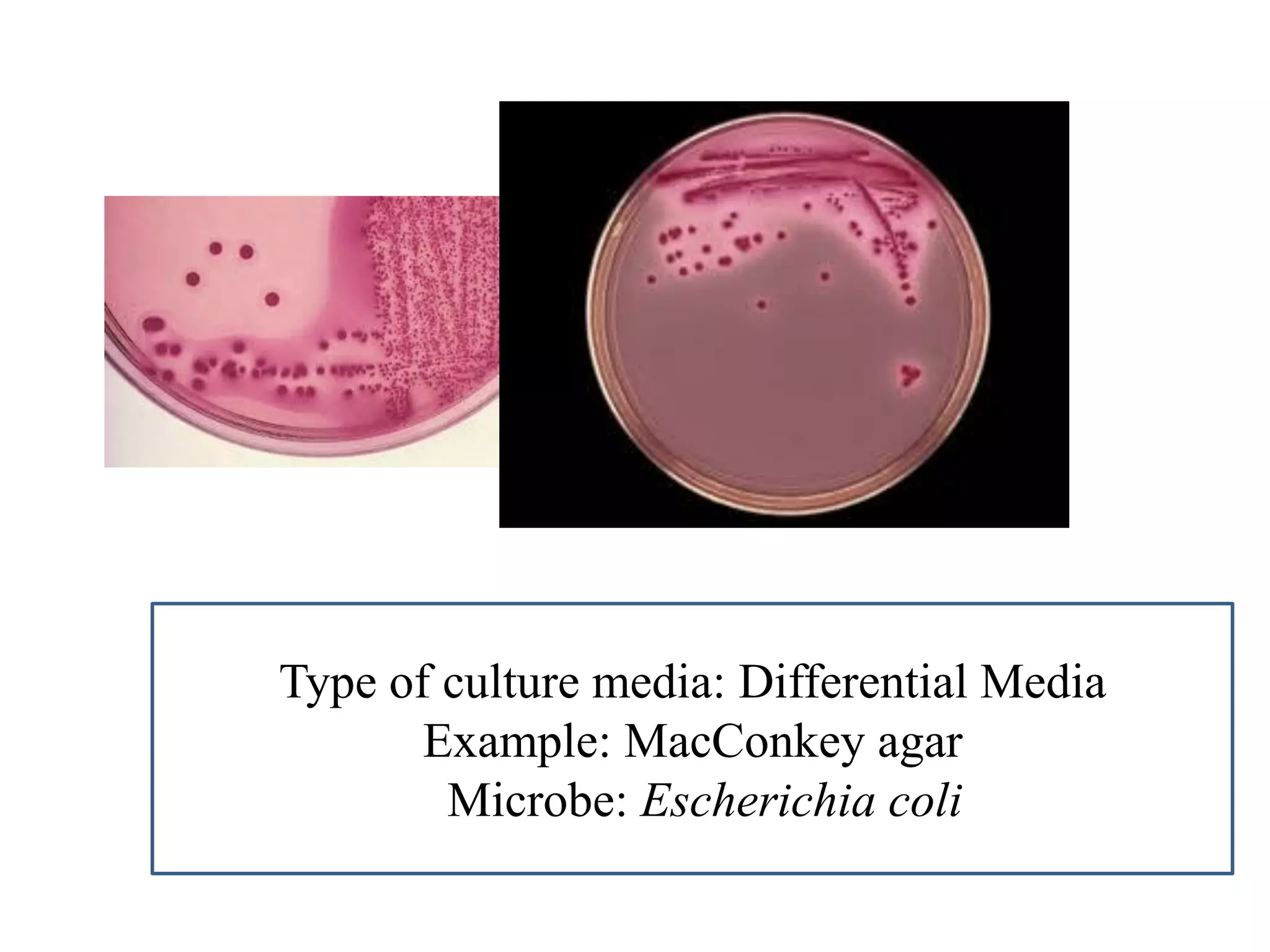 Type of culture media: Differential Media 
Example: MacConkey agar 
Microbe: Escherichia coli  