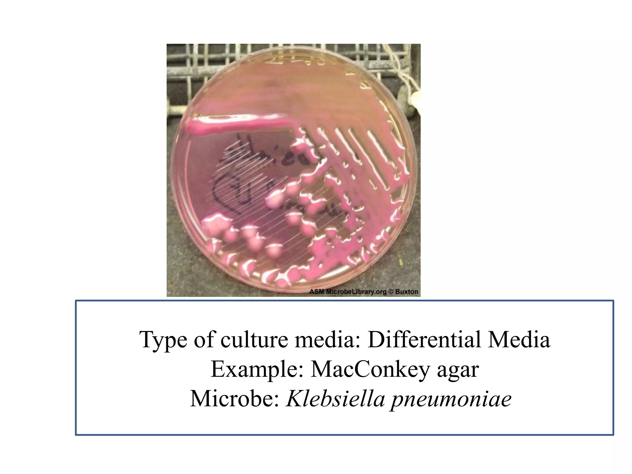 Type of culture media: Differential Media 
Example: MacConkey agar 
Microbe: Klebsiella pneumoniae  