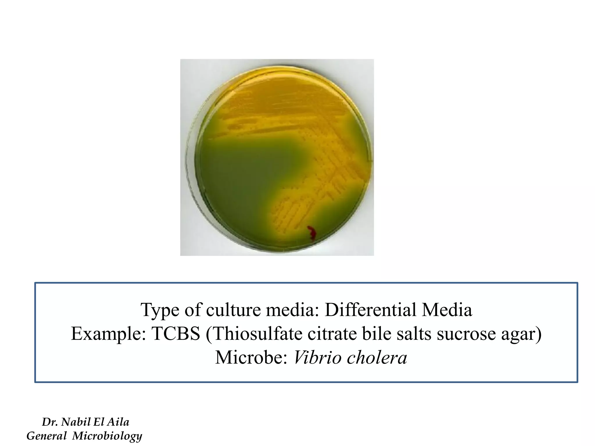 Type of culture media: Differential Media 
Example: TCBS (Thiosulfate citrate bile salts sucrose agar) 
Microbe: Vibrio cholera 
Dr. Nabil El Aila 
General Microbiology  