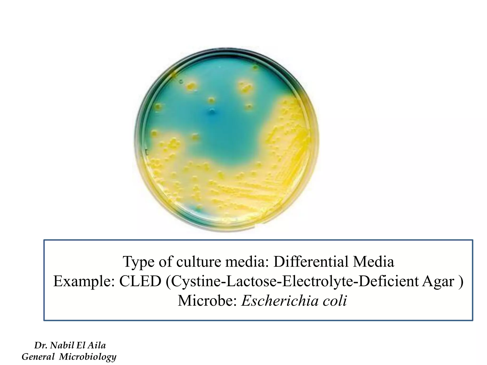 Type of culture media: Differential Media 
Example: CLED (Cystine-Lactose-Electrolyte-Deficient Agar ) 
Microbe: Escherichia coli 
Dr. Nabil El Aila 
General Microbiology  