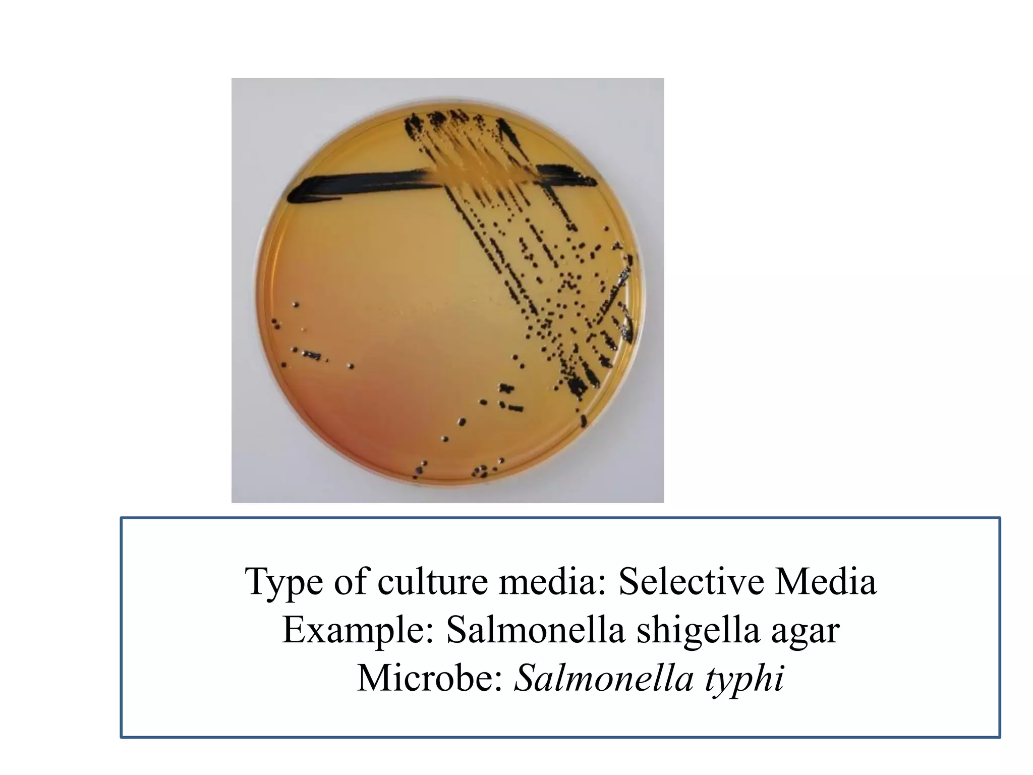 Type of culture media: Selective Media 
Example: Salmonella shigella agar 
Microbe: Salmonella typhi  