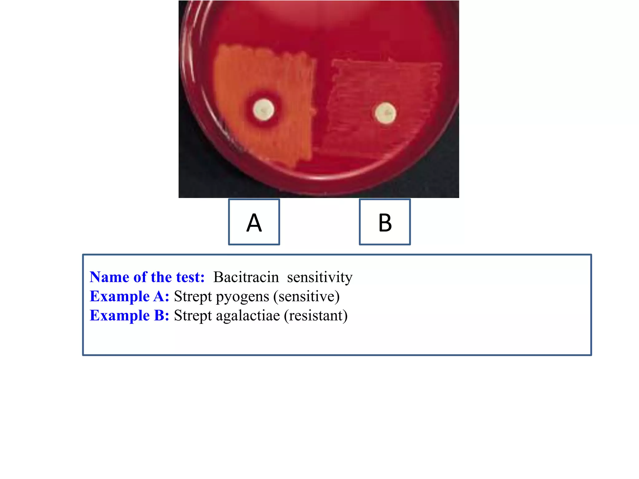 Name of the test: Bacitracin sensitivity 
Example A: Strept pyogens (sensitive) 
Example B: Strept agalactiae (resistant) 
A 
B  